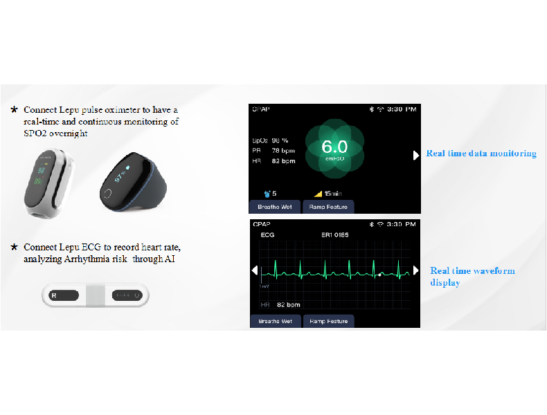 datafanyifanyiZaleta Obsuguje urzdzenia do noszenia Bluetooth, zmniejsza ograniczenia kablowe Obsugu...