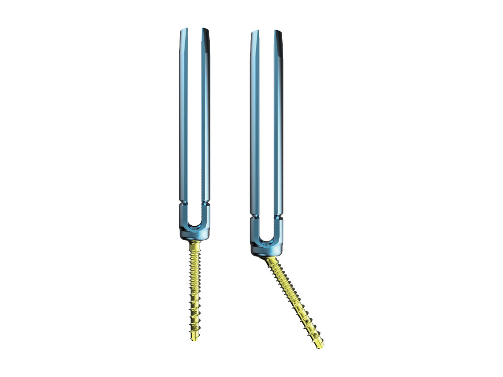 Posterior Spinal Internal Fixation (IX)